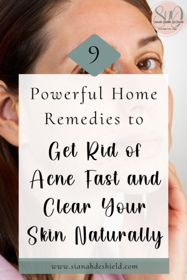 home remedies to get rid of acne fast